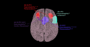 Summary of brain regions of interest. Hypnotizability
